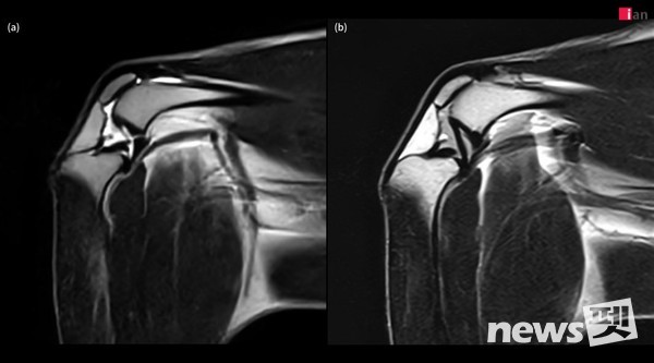 4kg 정상견의 전십자인대(a), 후십자인대(b). 사진 이안동물의학센터